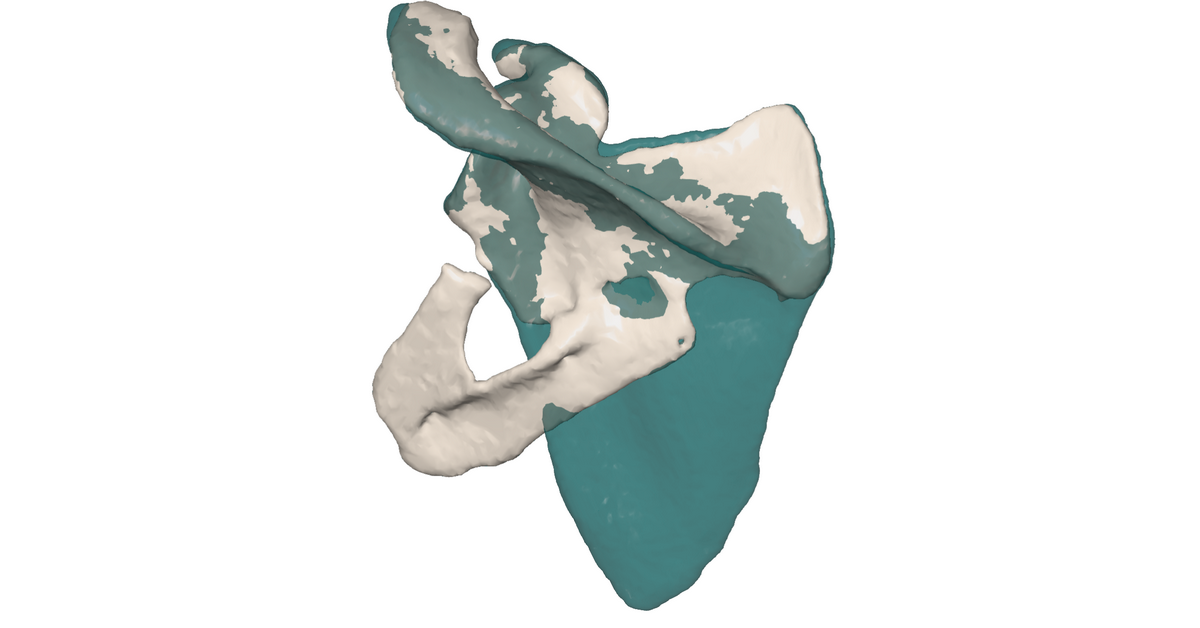 Wyznaczenie anatomicznego wzroca